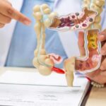 Dan con la clave del estreñimiento bacteriano, la enfermedad que reseca el intestino