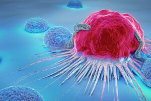 #Atención: Aumento de cáncer colorrectal en jóvenes preocupa a la comunidad médica