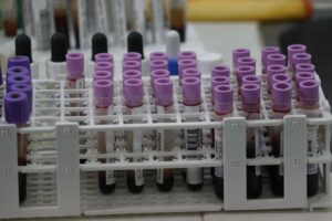 La IA puede ayudar a detectar personas en riesgo de sufrir cáncer